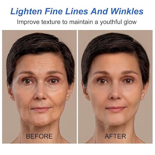 Botox Stock Solution suero antiarrugas
